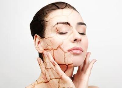 با انواع خشکی پوست و راهکارهای خانگی برای درمان هر یک آشنا شوید! با انواع خشکی پوست و راهکارهای خانگی برای درمان هر یک آشنا شوید!